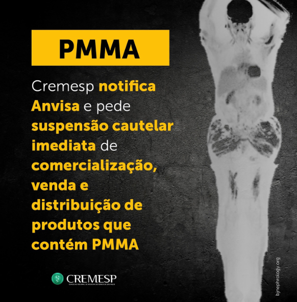 Cremesp notifica Anvisa e pede suspensão cautelar imediata de comercialização, venda e distribuição de produtos que contém PMMA.